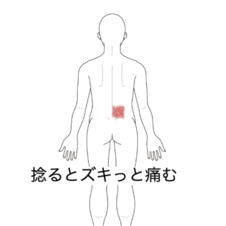 鍼灸の症例「ピッチャーの投球時に捻ると痛む腰」（香川県三豊市）