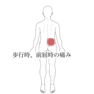鍼灸の症例「歩行時、前屈時にでる腰痛。」（長原駅／東京都品川区）