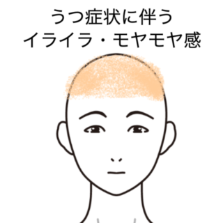 鍼灸の症例「うつ症状に伴うイライラ・モヤモヤ感に対する施術例」（島根県出雲市）