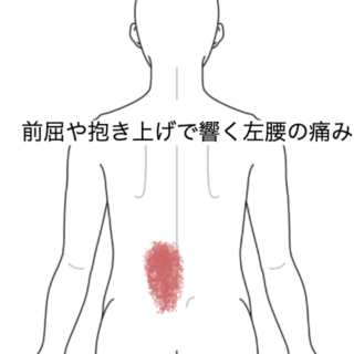 鍼灸の症例「前屈や抱き上げで響く左腰の痛み」（JR品川駅／東京都品川区）