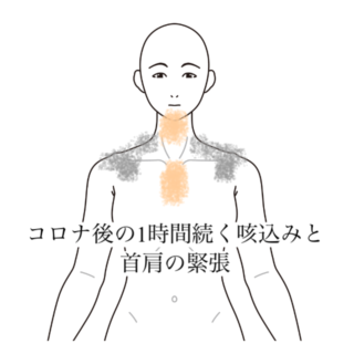 鍼灸の症例「コロナ後の1時間続く咳込みと首肩の緊張」（清澄白河）