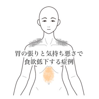 鍼灸の症例「胃の張りと気持ち悪さで食欲低下する症例」（清澄白河）