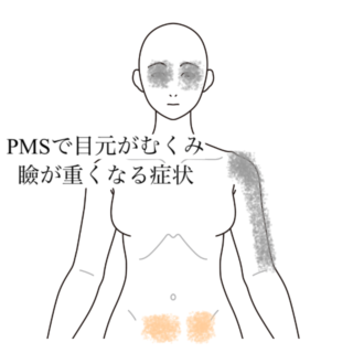鍼灸の症例「PMSで目元がむくみ瞼が重くなる症状」（清澄白河）