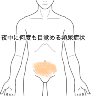 鍼灸の症例「夜中に何度も目覚める頻尿症状」（JR品川駅／東京都品川区）