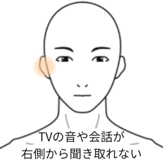 鍼灸の症例「突発性難聴によって、右側からの音が聴き取れない」（JR千里丘駅／大阪府吹田市）