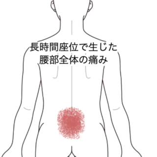 鍼灸の症例「長時間座位で生じた腰部全体の痛み」（JR品川駅／東京都品川区）