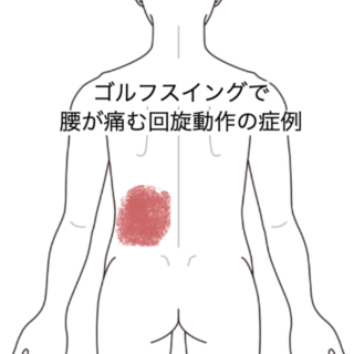 鍼灸の症例「ゴルフスイングで腰が痛む回旋動作の症例」（JR品川駅／東京都品川区）