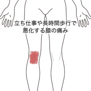 鍼灸症例|立ち仕事や長時間歩行で悪化する膝の痛み|JR品川駅/東京都品川区|はりきゅうルーム カポス