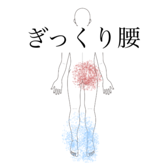鍼灸症例｜前屈みで痛む右腰部のぎっくり腰｜清澄白河｜鍼灸院ひなた　清澄白河