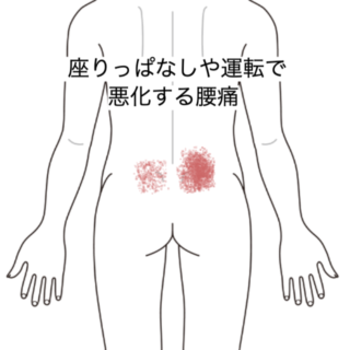 鍼灸症例|座りっぱなしや運転で悪化する腰痛|群馬県伊勢崎市|養気院