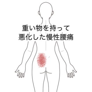 鍼灸症例|重い物を持って悪化した慢性腰痛に対する施術例|島根県出雲市|山岡鍼灸院