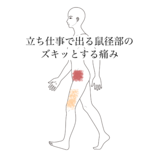 鍼灸症例｜立ち仕事で出る鼠径部のズキッとする痛み｜清澄白河｜鍼灸院ひなた　清澄白河