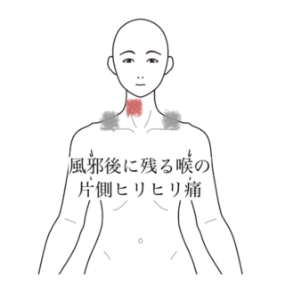 鍼灸症例｜風邪後に残る喉の片側ヒリヒリ痛｜清澄白河｜鍼灸院ひなた　清澄白河