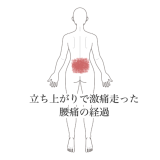 鍼灸症例｜立ち上がりで激痛走った腰痛の経過｜清澄白河｜鍼灸院ひなた　清澄白河