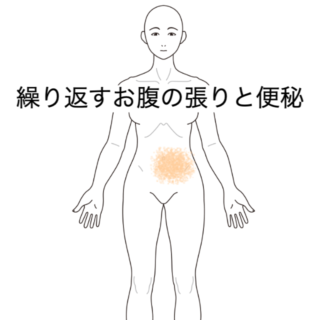 鍼灸症例｜繰り返すお腹の張りと便秘に対する施術例｜島根県出雲市｜山岡鍼灸院