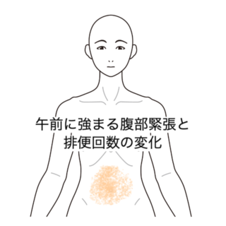 鍼灸症例｜午前に強まる腹部緊張と排便回数の変化｜清澄白河｜鍼灸院ひなた　清澄白河